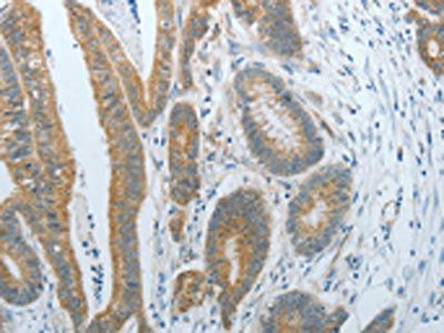 CXCR3 Antibody