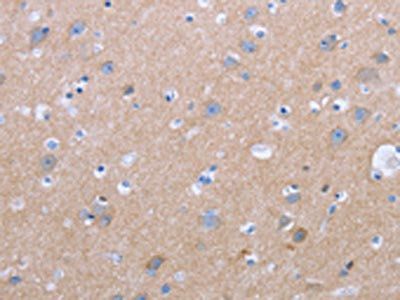 CXCR3 Antibody