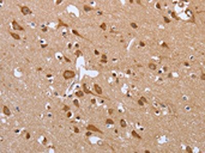 CXCR3 Antibody