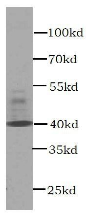 CXCR3B-specific antibody