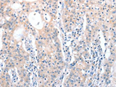 CXCR4 antibody