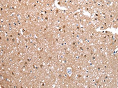CXCR4 Antibody