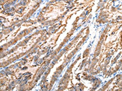 CXCR4 Antibody