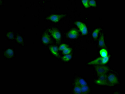 CXCR4 Recombinant Monoclonal Antibody