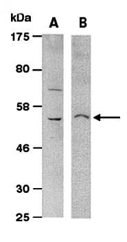 CXCR4 (vPairTM) Antibodies