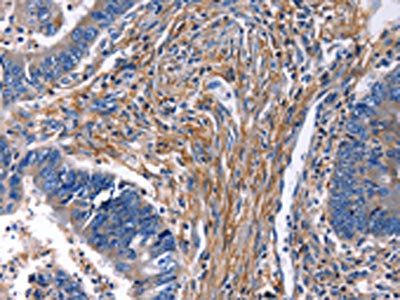 CXCR5 Antibody