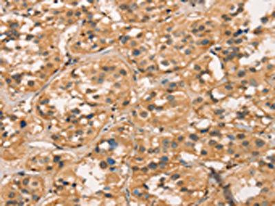 CXCR6 Antibody