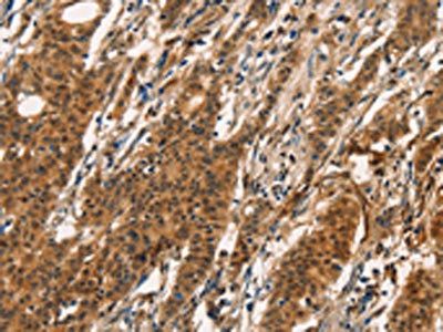CXCR6 Antibody