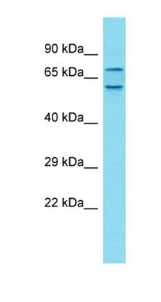 CXorf30 antibody