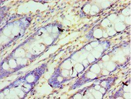 CXXC1 Antibody