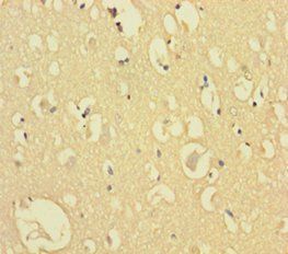 CXXC5 Antibody