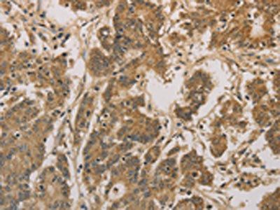 CXXC5 Antibody