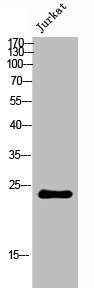 CYB561D2 Antibody