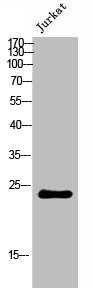 CYB561D2 antibody