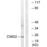 CYB561D2 antibody