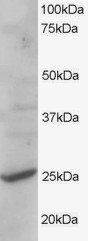 Goat anti-CYB561D2 Antibody