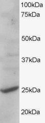 CYB561D2 antibody