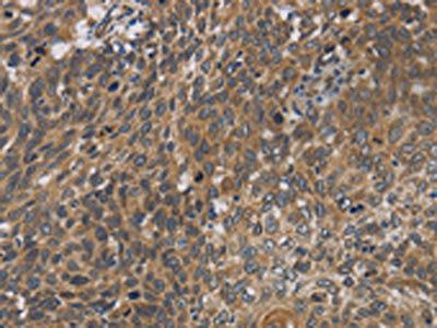CYB5A Antibody