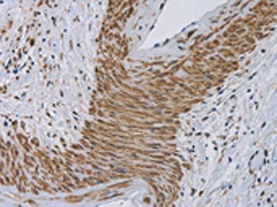 CYB5A Antibody