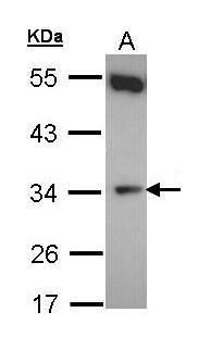 CYB5R1 antibody [N1C3]