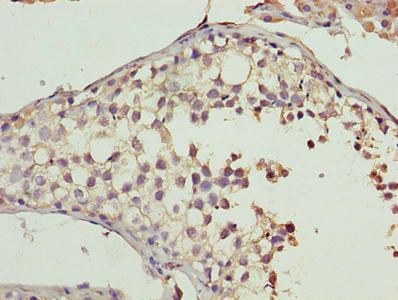 CYB5R2 antibody