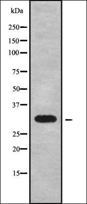 CYB5R2 antibody