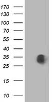 CYB5R3 Antibody