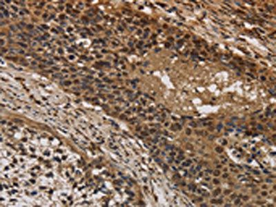 CYBA Antibody