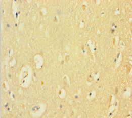 CYBB Antibody