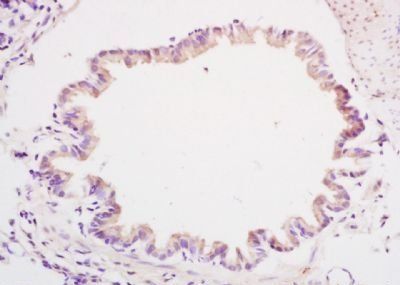 CYBR1 Rabbit Polyclonal Antibody