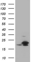 Cyclin A2 (CCNA2) antibody