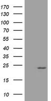 Cyclin B2 (CCNB2) antibody
