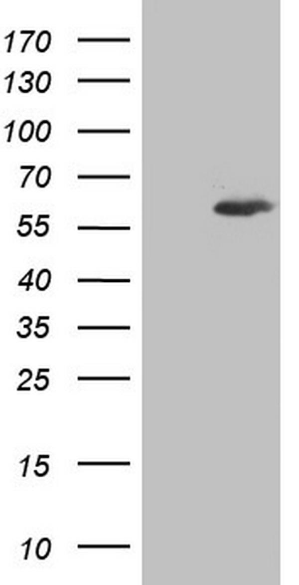 Cyclin D1 (CCND1) antibody