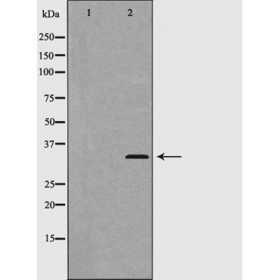 Cyclin D2 (Phospho-Thr280) antibody