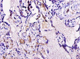 Cyclin-dependent kinase 2-associated protein 1 antibody