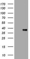 Cyclin E2 (CCNE2) antibody