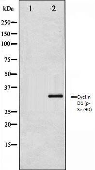 Cyclin D1 (phospho-Ser90) antibody