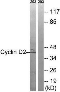 Cyclin D2 (Ab-280) Antibody