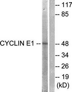 Cyclin E1 (Ab-395) Antibody
