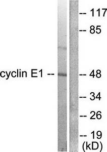 Cyclin E1 Antibody