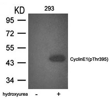 Cyclin E1 (phospho-Thr395) Antibody