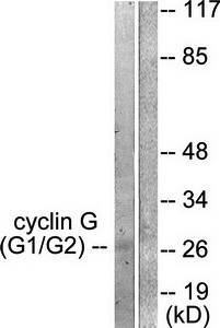Cyclin G antibody