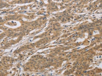 CYFIP2 antibody