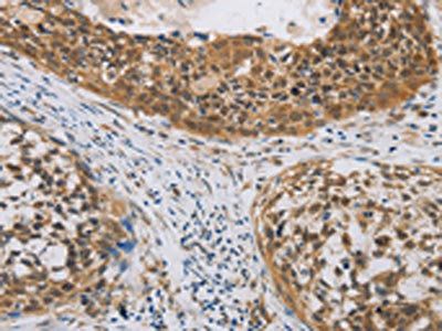 CYFIP2 Antibody