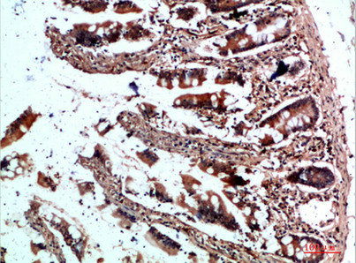 CYFIP2 Antibody