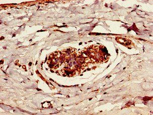 CYLD Antibody