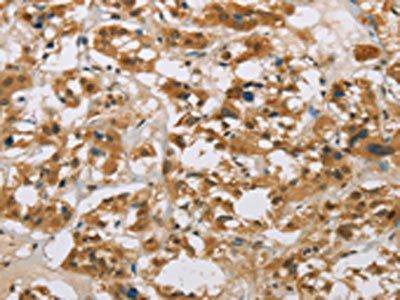CYP11B1 Antibody