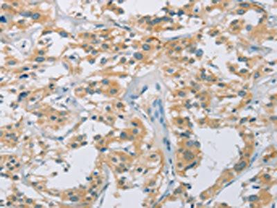 CYP11B1 Antibody