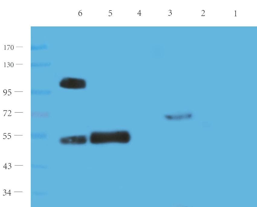 CYP11B1 antibody