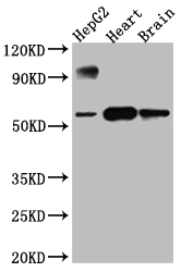 CYP17A1 Recombinant Monoclonal Antibody